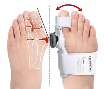 Valgus dlaha nastaviteľná - ako zastaviť hallux valgus