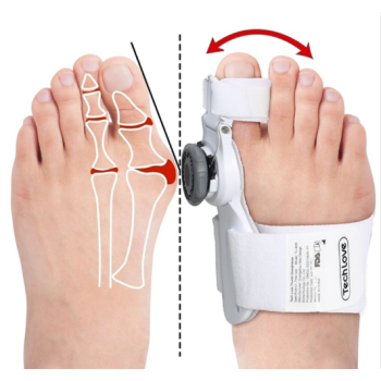 Valgus dlaha nastaviteľná - ako zastaviť hallux valgus