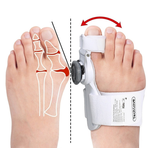 Valgus dlaha pomocka nastaviteľná Bandáž korektor na hallux valgus