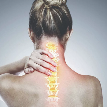 Cervikálna spondylóza: príčiny, príznaky a liečba